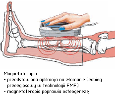 Magnetoterapia